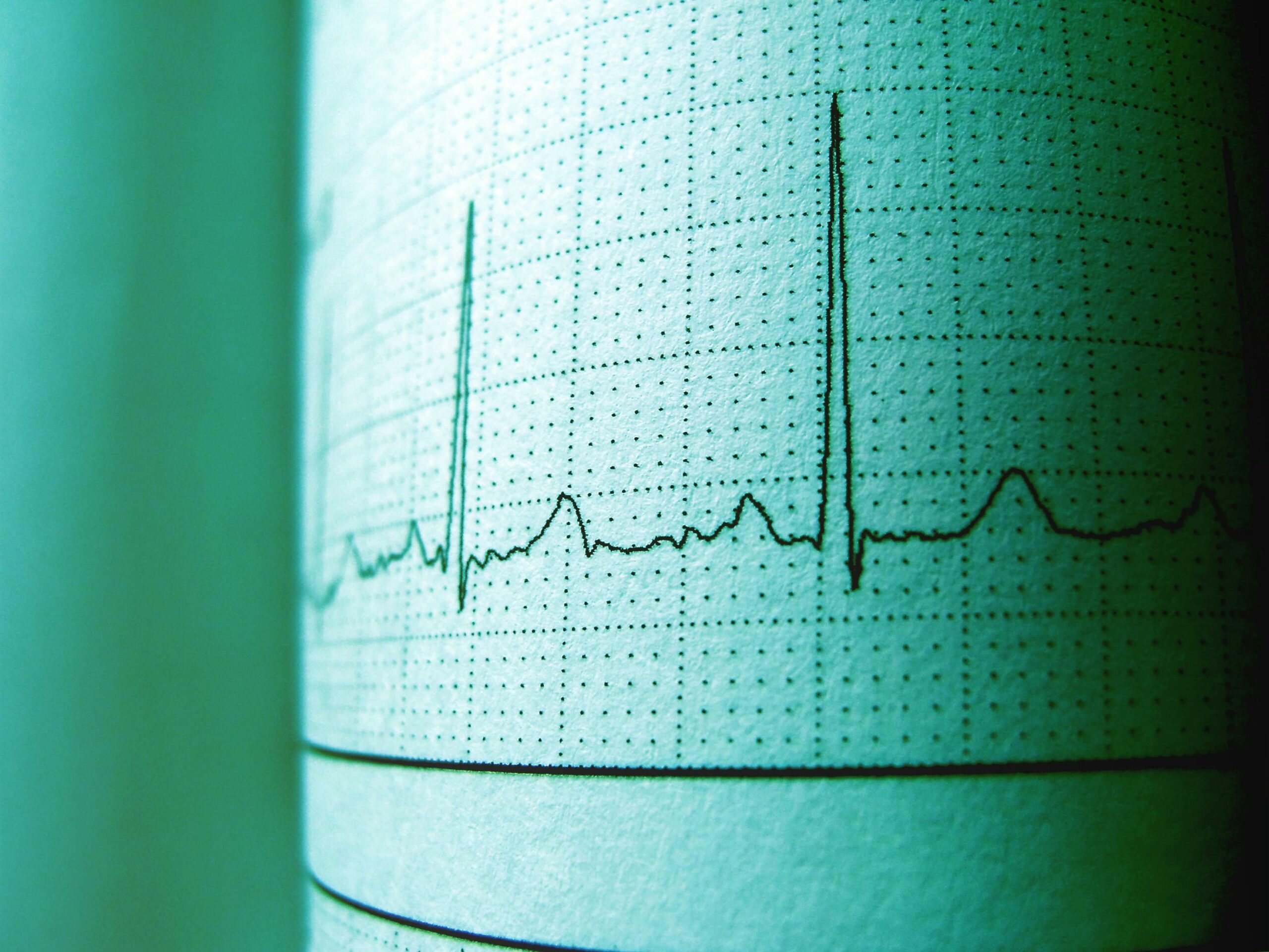 ECG heartbeat trace on green grid paper — photo by Rezende Luan on Pexels